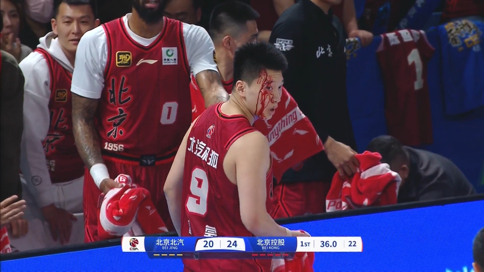 九游会j9官网真人游戏第一品牌太硬了！雷蒙眼角缝完10针后今天正常训练